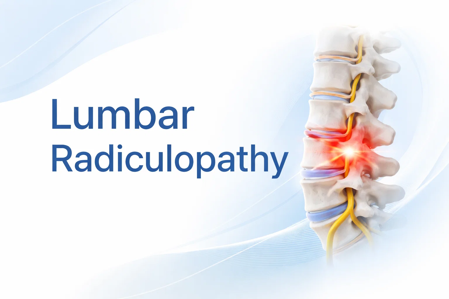 Lumbar Radiculopathy